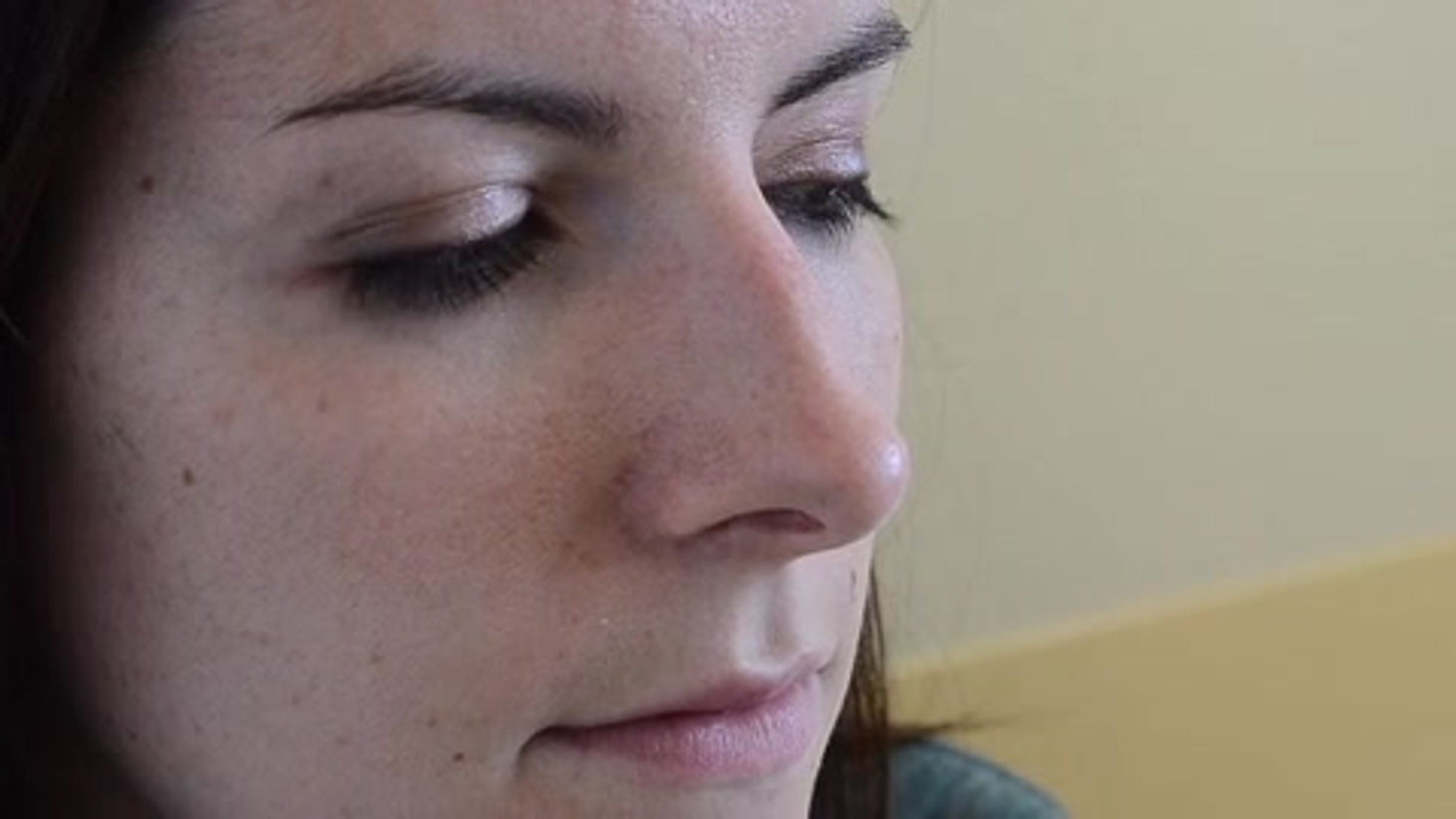 Test au miroir - recherche d'une obstruction nasale